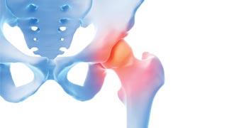 What is causing your hip pain?