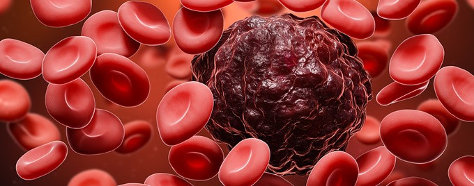 Image showing a cancer cell among blood cells