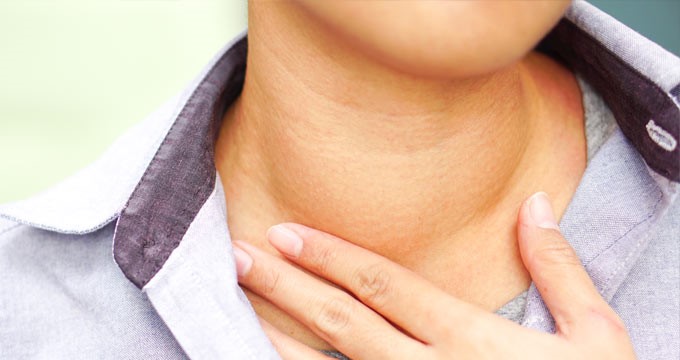 Woman with a pronounced neck lump