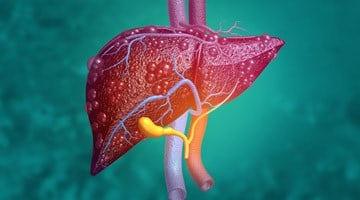 image_livercirrhosis