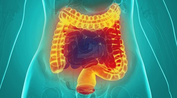 image_livingwithibd