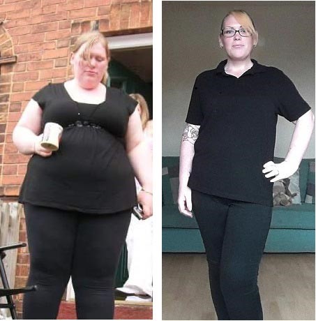 Cheryl Young before and after her gastric bypass surgery