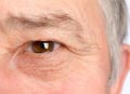 Free mini appointments - Cataracts and Glaucoma
