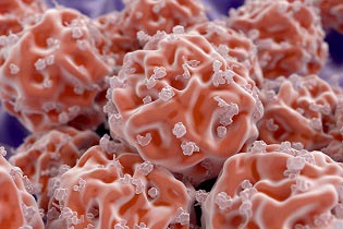 Stem cell therapy & arthritis of the hip treatment