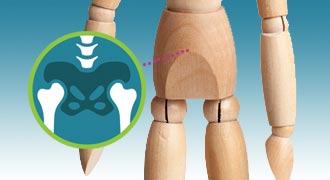 Hip replacement surgery