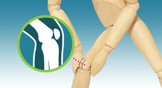 Knee replacement surgery