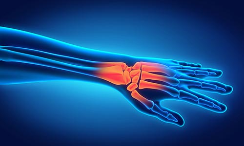 Hand and wrist pain information evening