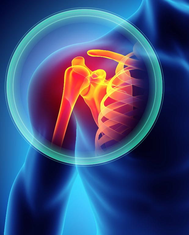 Free information event on common shoulder problems