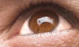 Getting to grips with glaucoma