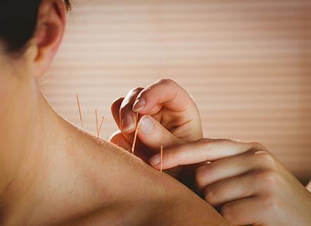 Dear doctor, will acupuncture help relieve my neck pain?