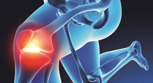 National Arthritis Week 2018 - Don't just 'live with it'
