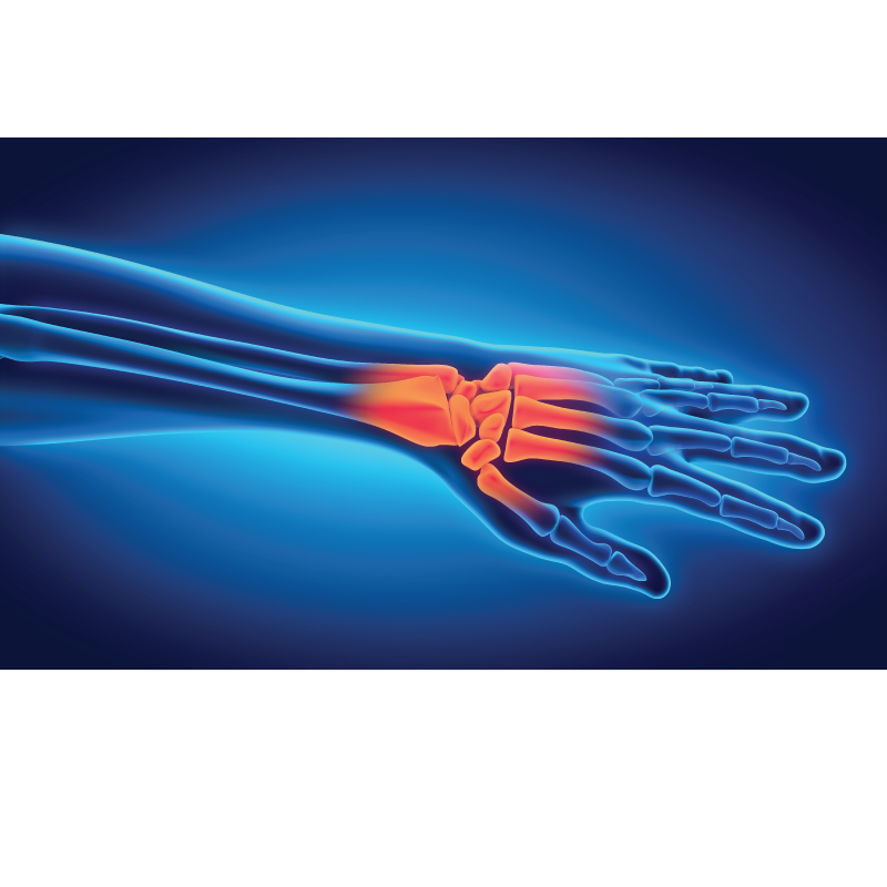 Common hand problems - free information evening