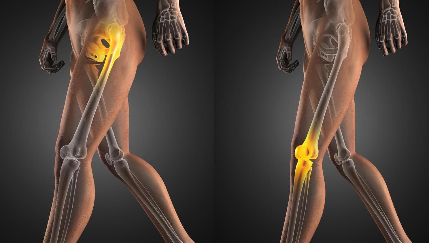 Free hip and knee pain event