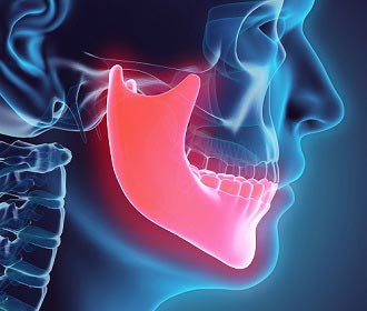Jaw and dental evening