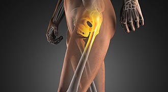 Lower limb joint injections
