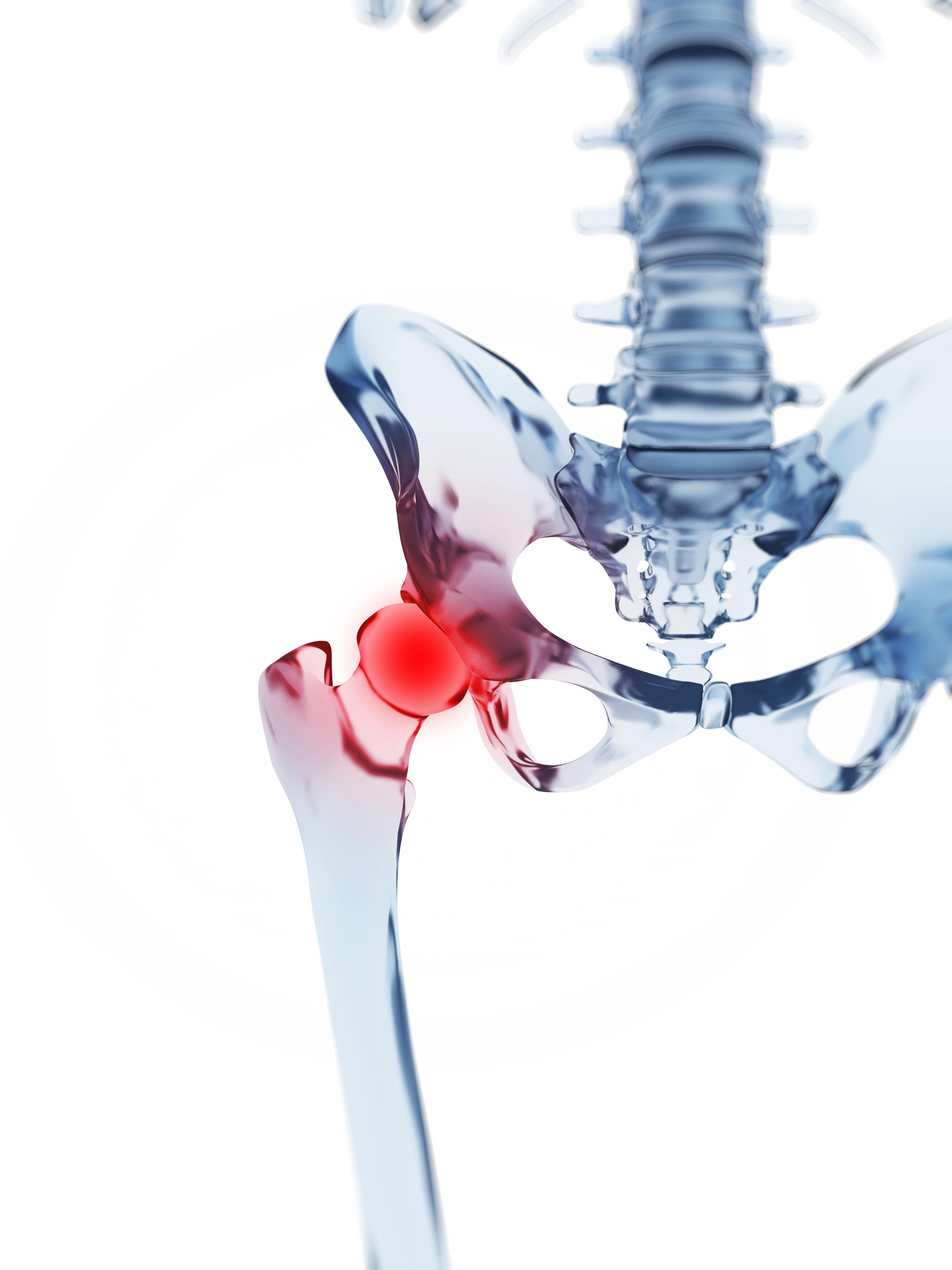 Hip pain patient information evening