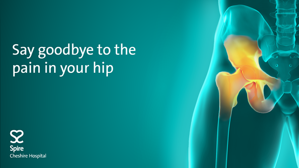 ‘Meet the experts’ - free hip pain information evening