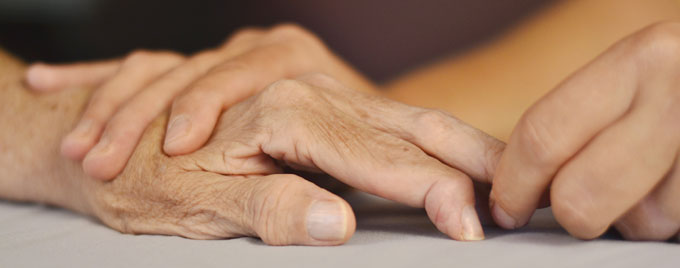 Close up of hands suffering with rheumatoid artritis