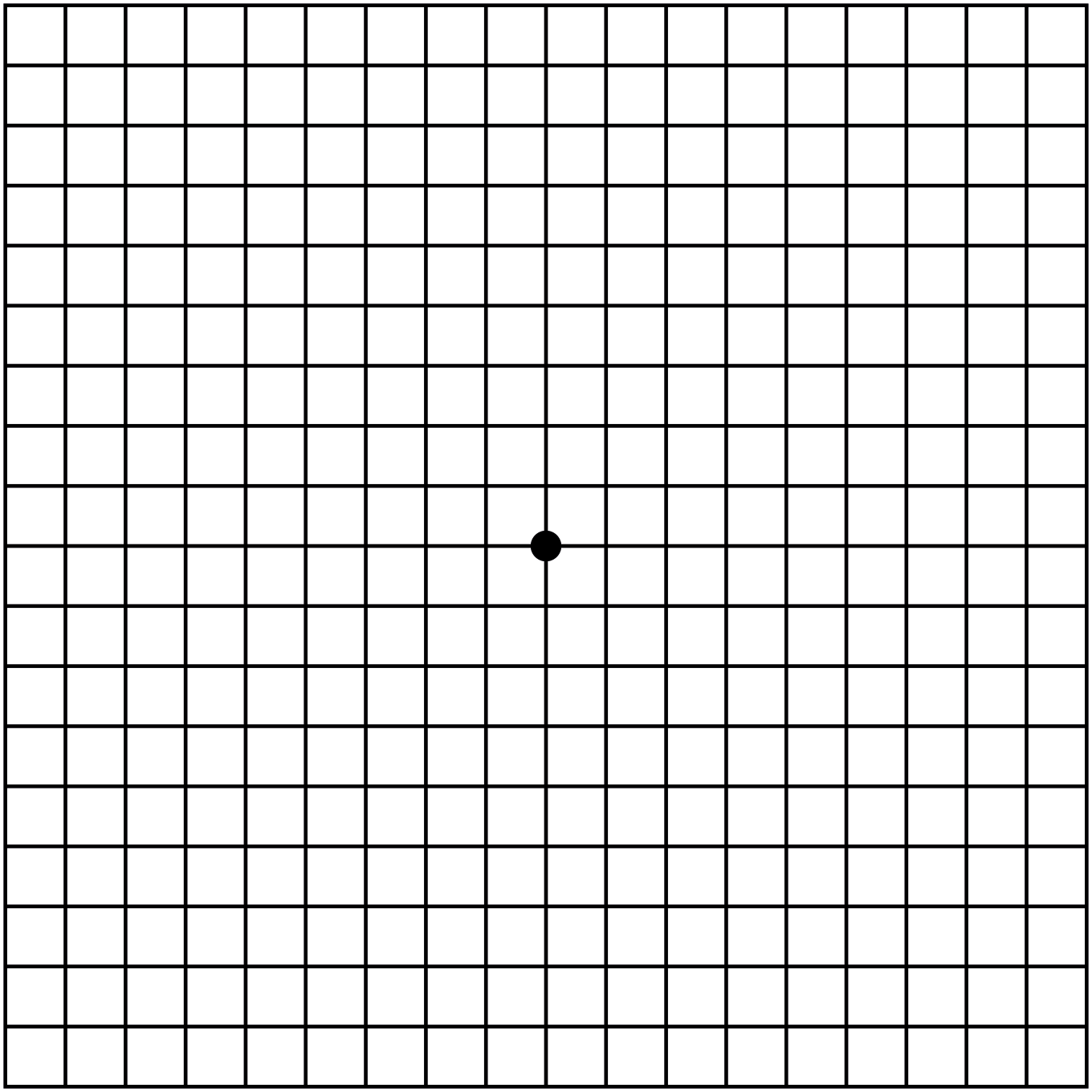 Age-related Macular Degeneration: Using The Amsler Grid — Costello Opticians