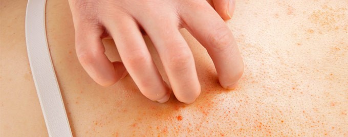 skin moles to worry about