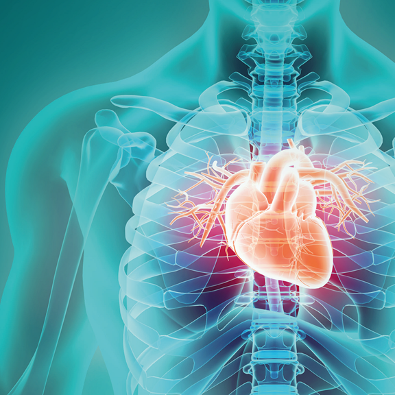 Understanding Angina Understanding angina: from diagnosis to treatment | Spire Healthcare