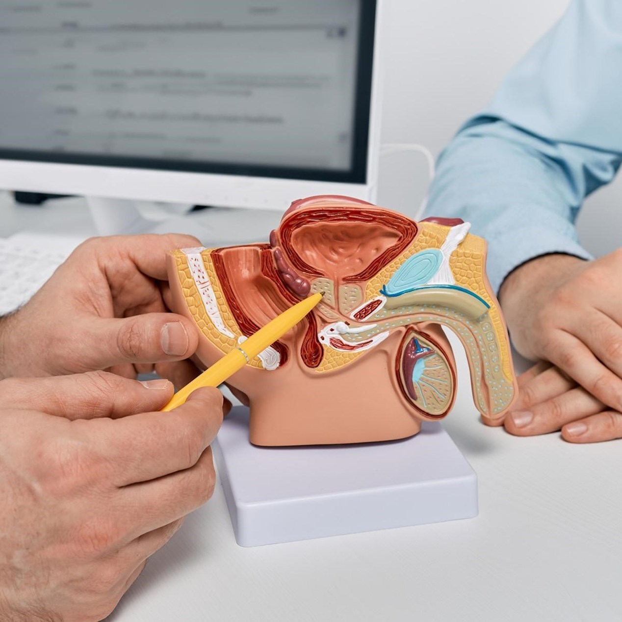 Spire Yale Hospital announces use of SpaceOAR® Hydrogel for prostate cancer radiation therapy
