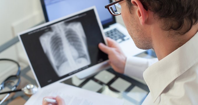 A doctor studies a patients lung xray