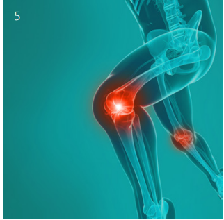 Knee ligament injuries