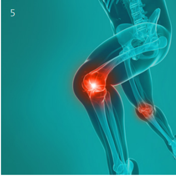 Knee ligament injuries