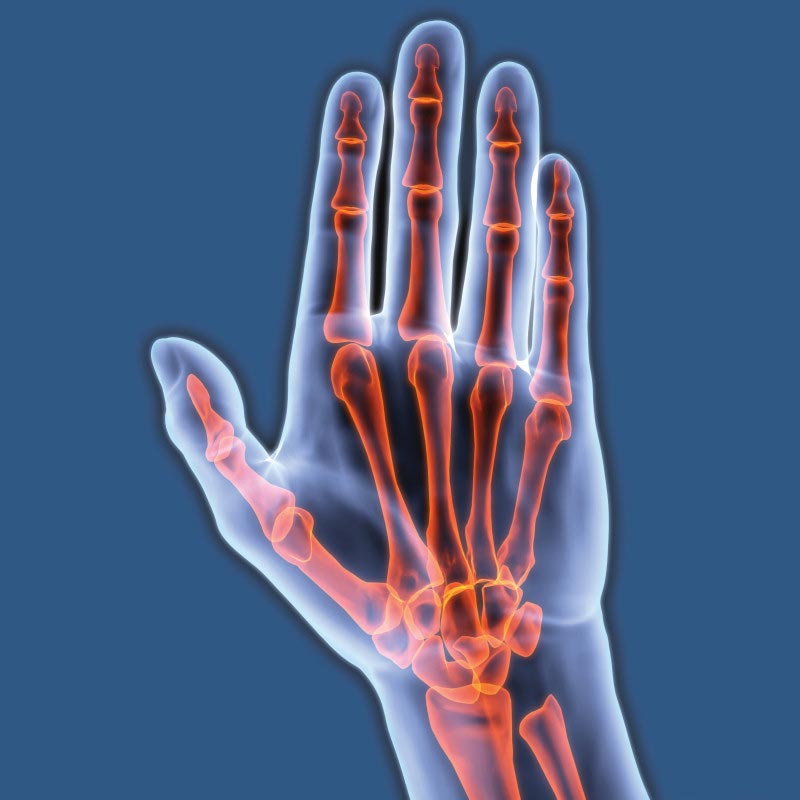 Hand surgery at Spire Dunedin Hospital, Reading